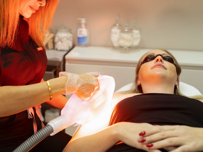 Laser Hair Removal